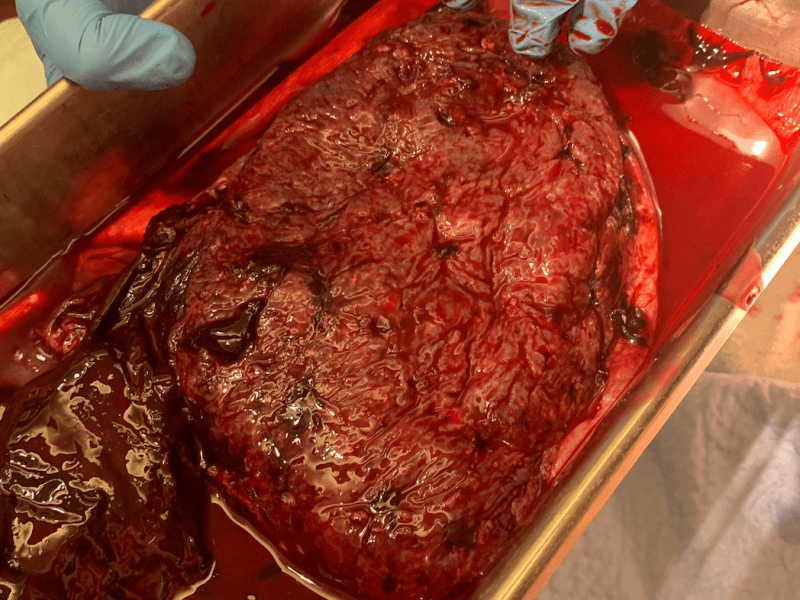 What’s the deal with placenta&nbsp;consumption?